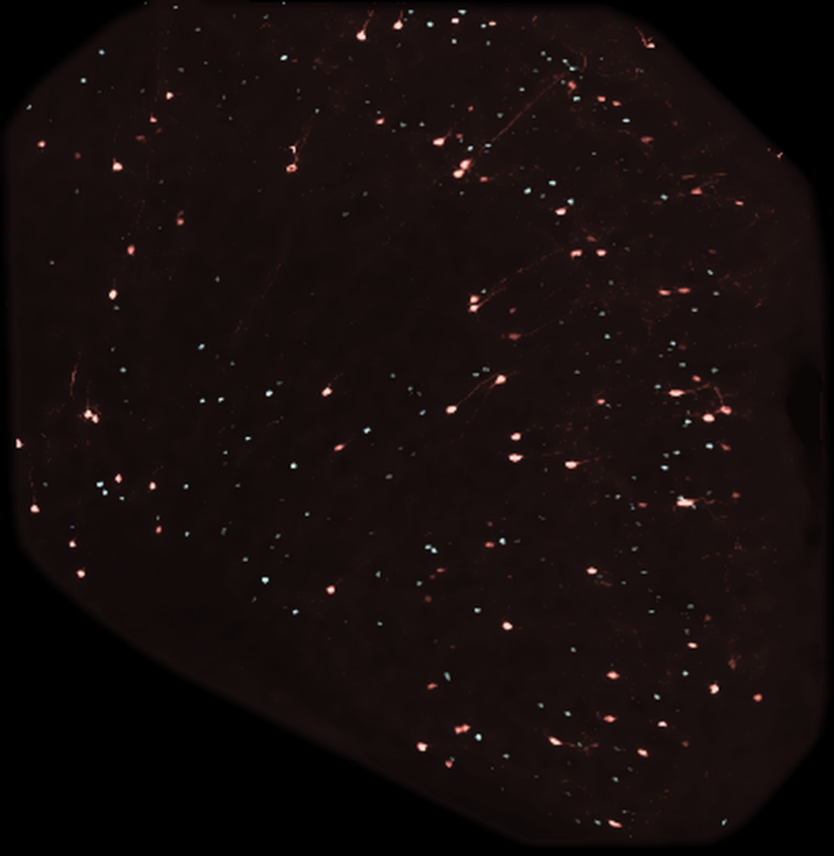 Anterior cingulate cortex showing neurons activated by IL-31 in teal and by IL-1 beta in red