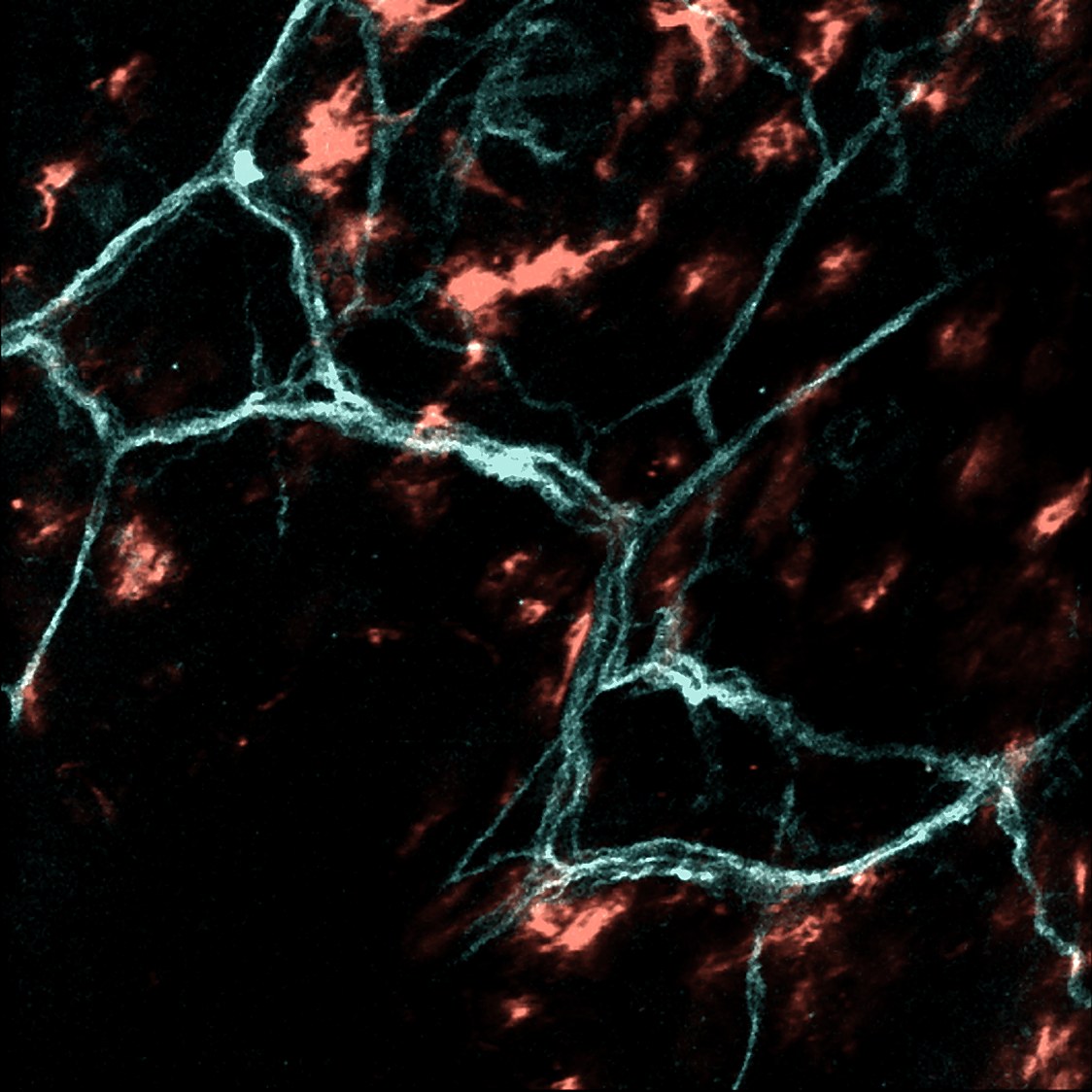 Network of nerve fibers in teal with antigen-presenting cells in red